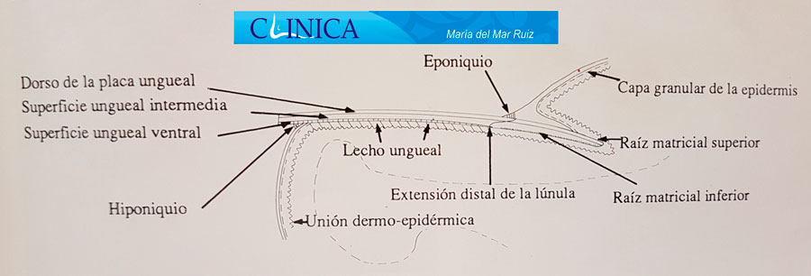 Componentes de la uña Uña-encarnada-u-Onicocriptosis