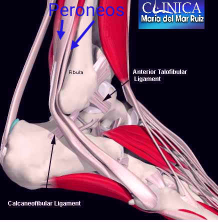 Anatomía de la cara lateral del tobillo mostrando los tendones peroneos y ligamentos laterales